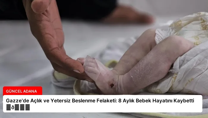 Gazze’de Açlık ve Yetersiz Beslenme Felaketi: 8 Aylık Bebek Hayatını Kaybetti ⏬👇