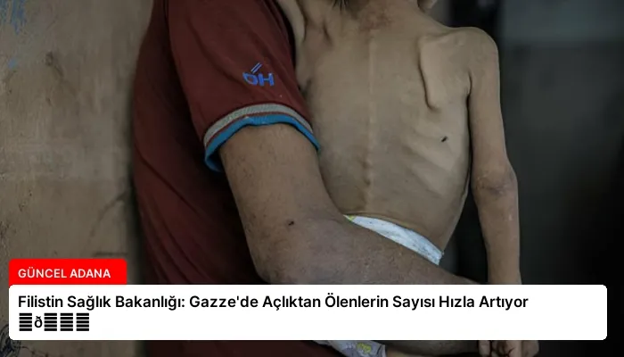 Filistin Sağlık Bakanlığı: Gazze’de Açlıktan Ölenlerin Sayısı Hızla Artıyor ⏬👇