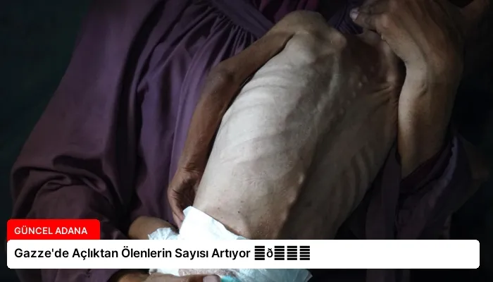 Gazze’de Açlıktan Ölenlerin Sayısı Artıyor ⏬👇