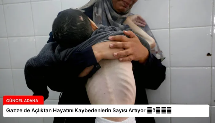 Gazze’de Açlıktan Hayatını Kaybedenlerin Sayısı Artıyor ⏬👇