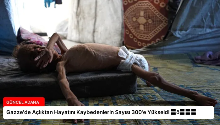 Gazze’de Açlıktan Hayatını Kaybedenlerin Sayısı 300’e Yükseldi ⏬👇