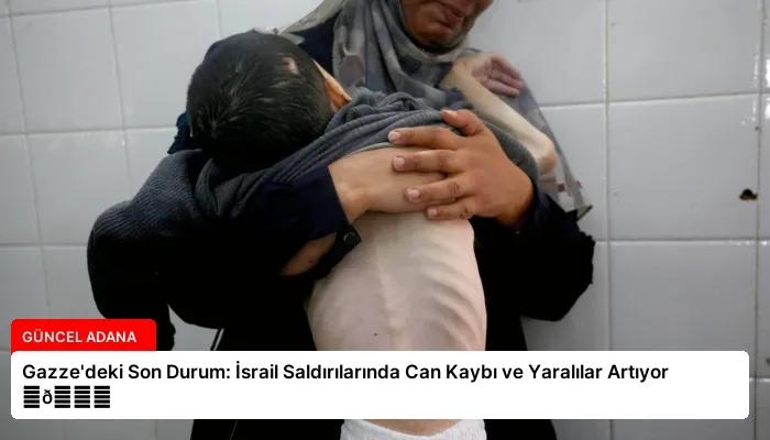 Gazze’deki Son Durum: İsrail Saldırılarında Can Kaybı ve Yaralılar Artıyor ⏬👇