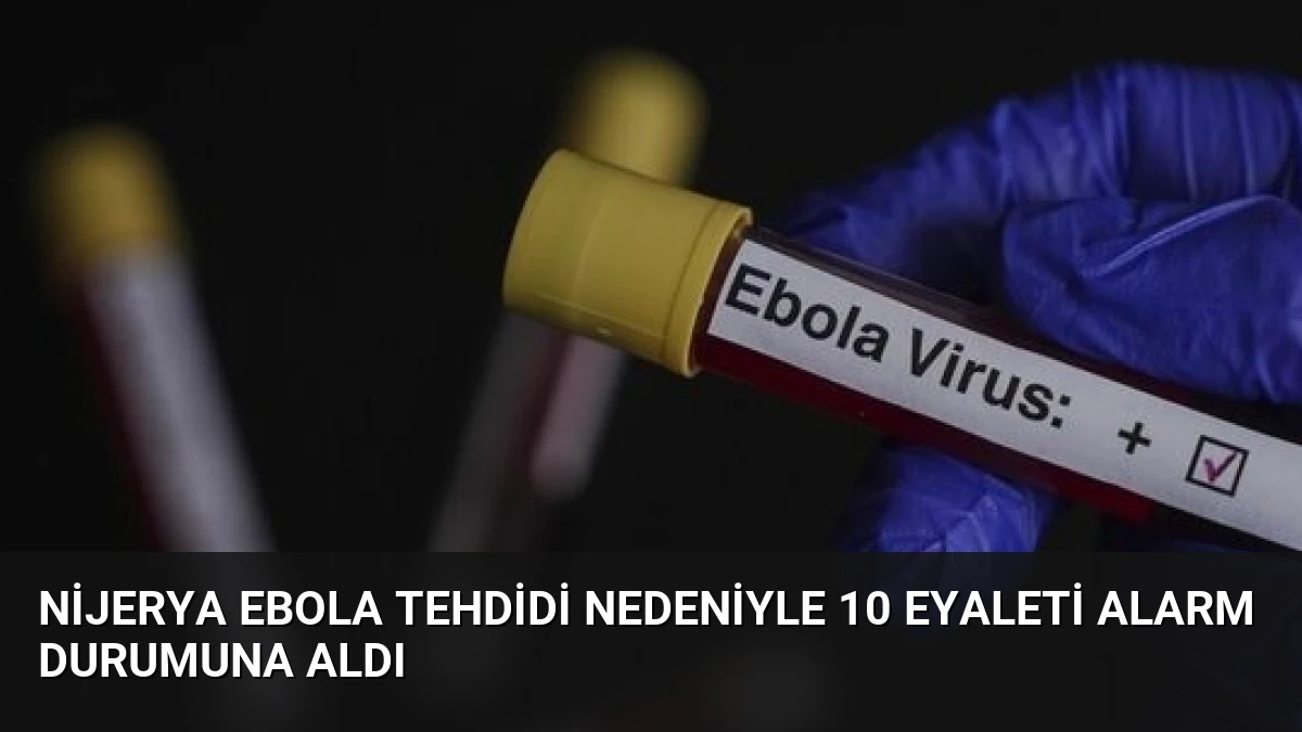 Nijerya Ebola Tehdidi Nedeniyle 10 Eyaleti Alarm Durumuna Aldı